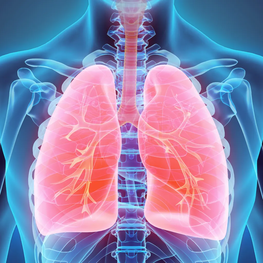 Illustration of Lung Cancer